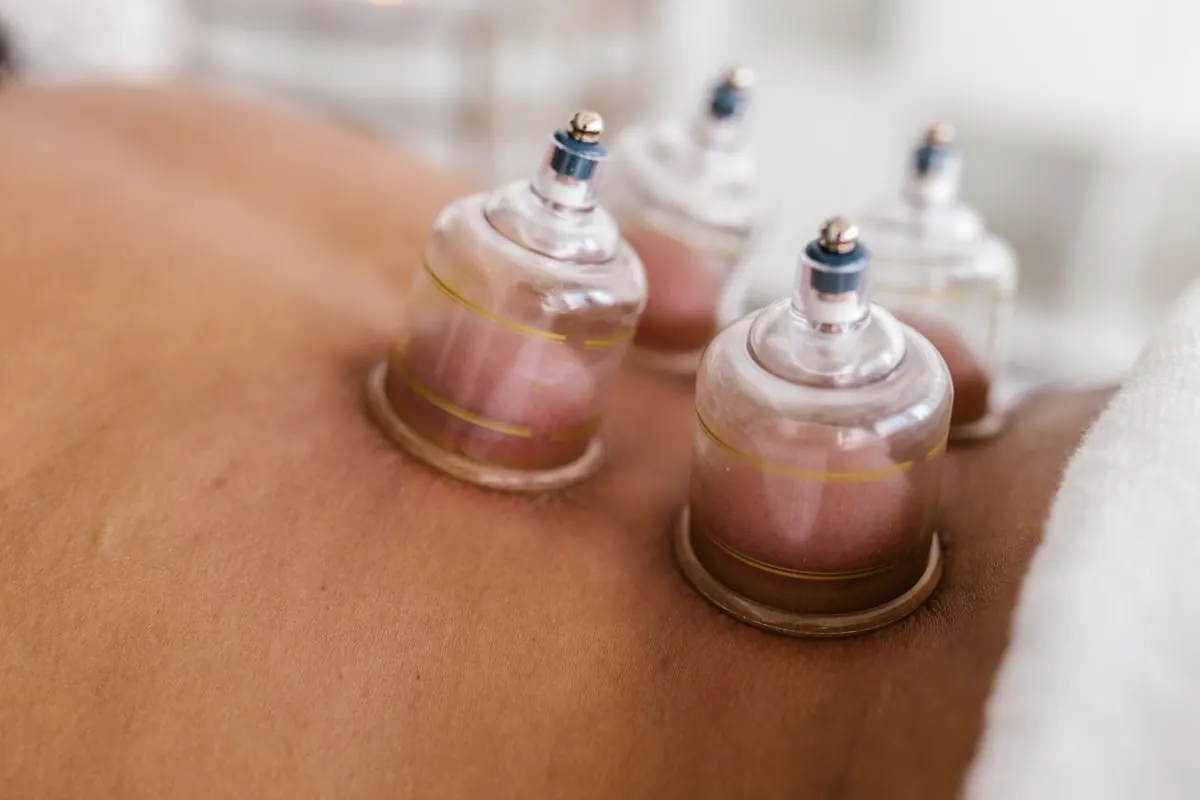Cupping thérapie